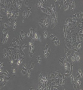 ACC-2人涎腺腺樣囊性癌細胞主圖