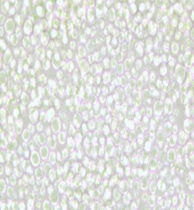 OKT 11小鼠雜交瘤細(xì)胞(抗CD2)主圖