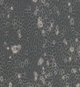 ME-180人子宮頸表皮癌細(xì)胞主圖