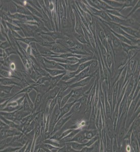 MG-63人骨肉瘤細胞主圖