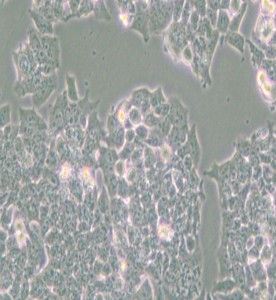 NCI-H520人肺鱗癌細(xì)胞主圖