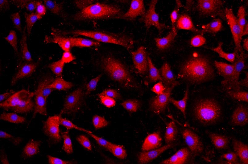 小鼠肺微血管內皮細胞主圖