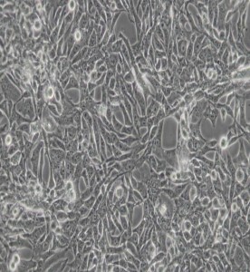 RD人惡性胚胎橫紋肌瘤細(xì)胞主圖