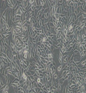 RKO人結腸腺癌細胞主圖