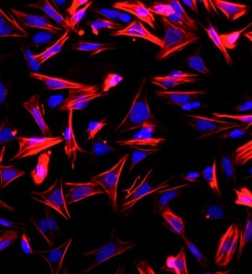 大鼠小腸平滑肌細胞主圖