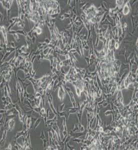 SK-N-BE(2)人神經母細胞瘤細胞主圖
