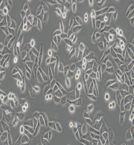SK-OV-3人卵巢癌細胞主圖