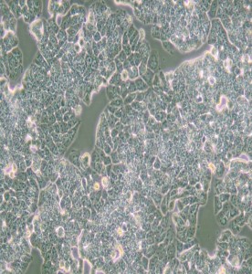 T-47D人乳腺管癌細胞主圖