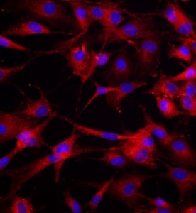 大鼠骨髓來源內(nèi)皮祖細胞主圖