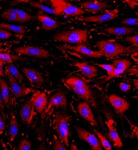 大鼠心臟微血管內皮細胞主圖