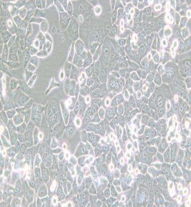 NCI-H2126人肺癌細胞主圖