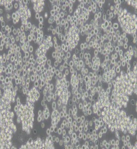 Raji人Burkitt's淋巴瘤細(xì)胞主圖