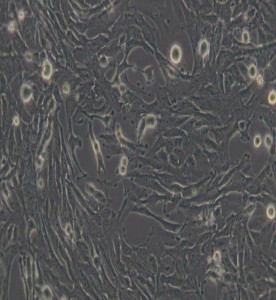 U251人膠質瘤細胞主圖