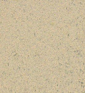 U266 [U266B1]人多發(fā)性骨髓瘤細(xì)胞主圖