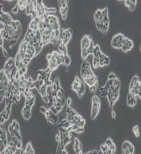 ZR-75-1人乳腺癌細胞主圖