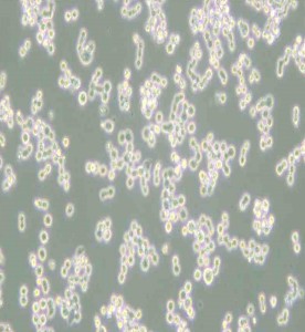 COLO-320DM人結(jié)直腸腺癌細胞主圖