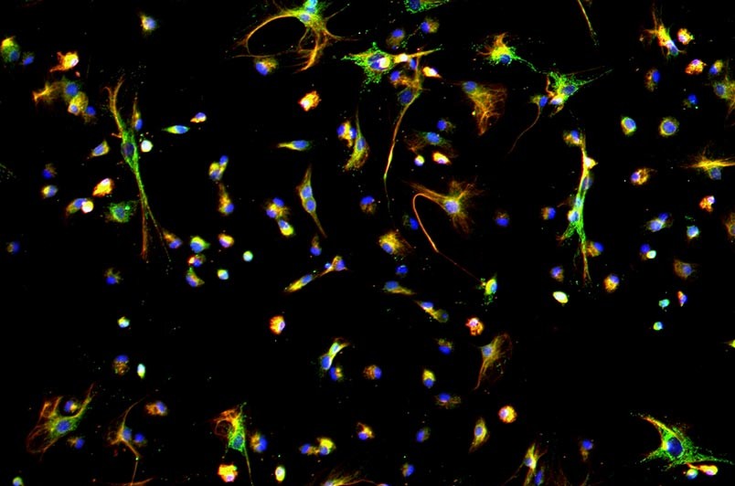 小鼠腹膜間皮細胞主圖