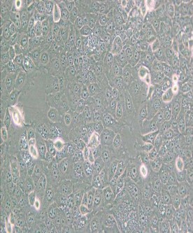 KYSE-30人食管鱗癌細(xì)胞主圖