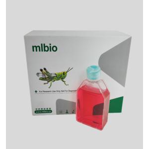 人滑膜成纖維細(xì)胞(類風(fēng)濕關(guān)節(jié)炎)主圖