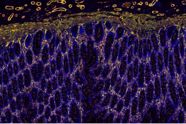 免疫熒光三標四色染色主圖